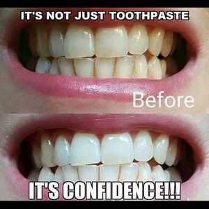 Whitening Toothpaste